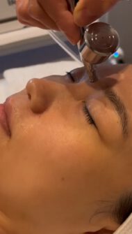 Oxygen facial treatment