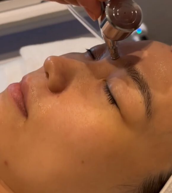 Oxygen facial treatment