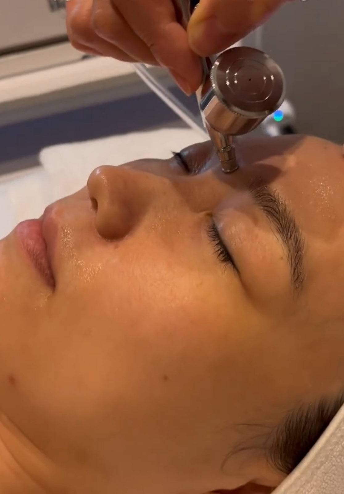 Oxygen facial treatment